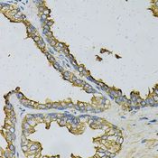 RPLP0 Antibody - Immunohistochemistry of paraffin-embedded human prostate using RPLP0 Antibody at dilution of 1:100 (40x lens).