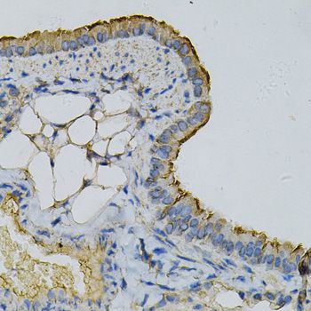 RPLP0 Antibody - Immunohistochemistry of paraffin-embedded mouse lung using RPLP0 Antibody at dilution of 1:100 (40x lens).