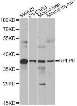 RPLP0 Antibody - Western blot analysis of extracts of various cell lines, using RPLP0 antibody at 1:1000 dilution. The secondary antibody used was an HRP Goat Anti-Rabbit IgG (H+L) at 1:10000 dilution. Lysates were loaded 25ug per lane and 3% nonfat dry milk in TBST was used for blocking. An ECL Kit was used for detection and the exposure time was 90s.