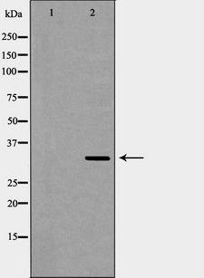 RPLP0 Antibody - Western blot analysis of HeLa whole cells lysates using RPLP0 antibody. The lane on the left is treated with the antigen-specific peptide.