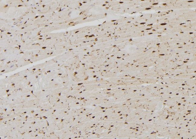 RPLP0 Antibody - 1:100 staining rat heart tissue by IHC-P. The sample was formaldehyde fixed and a heat mediated antigen retrieval step in citrate buffer was performed. The sample was then blocked and incubated with the antibody for 1.5 hours at 22°C. An HRP conjugated goat anti-rabbit antibody was used as the secondary.