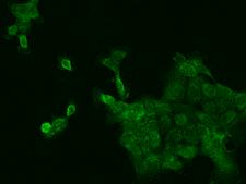 RPLP0 Antibody - Immunofluorescence staining of RPLP0 in A431 cells. Cells were fixed with 4% PFA, permeabilzed with 0.1% Triton X-100 in PBS, blocked with 10% serum, and incubated with rabbit anti-Human RPLP0 polyclonal antibody (dilution ratio 1:200) at 4°C overnight. Then cells were stained with the Alexa Fluor 488-conjugated Goat Anti-rabbit IgG secondary antibody (green). Positive staining was localized to Cytoplasm.
