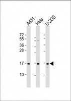 RPLP1 Antibody - All lanes: Anti-RPLP1 Antibody (N-Term) at 1:2000 dilution. Lane 1: A431 whole cell lysate. Lane 2: HeLa whole cell lysate. Lane 3: U-2OS whole cell lysate Lysates/proteins at 20 ug per lane. Secondary Goat Anti-Rabbit IgG, (H+L), Peroxidase conjugated at 1:10000 dilution. Predicted band size: 12 kDa. Blocking/Dilution buffer: 5% NFDM/TBST.