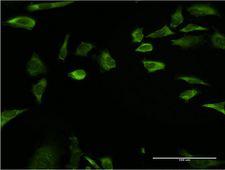 RPLP1 Antibody - Immunofluorescence of monoclonal antibody to RPLP1 on HeLa cell . [antibody concentration 10 ug/ml]