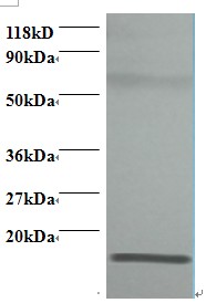 RPLP1 Antibody - Western blot of 60S acidic ribosomal protein P1 antibody at 2 ug/ml. Lane 1: EC109 whole cell lysate. Lane 2: 293T whole cell lysate. Secondary: Goat polyclonal to Rabbit IgG at 1:15000 dilution. Predicted band size: 12.6 kDa. Observed band size: 12.6 kDa Additional bands at: 60 kDa. We are unsure as to the identity of this extra band.  This image was taken for the unconjugated form of this product. Other forms have not been tested.