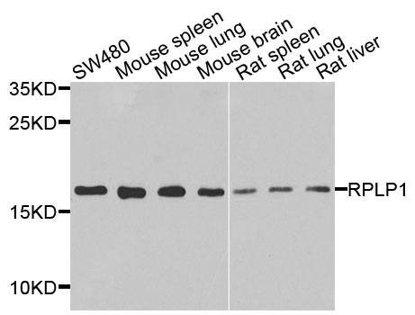 RPLP1 Antibody - Western blot analysis of extracts of various cells.
