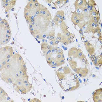 RPLP1 Antibody - Immunohistochemistry of paraffin-embedded human stomach tissue.