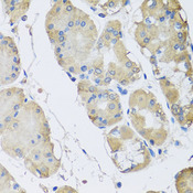 RPLP1 Antibody - Immunohistochemistry of paraffin-embedded human stomach tissue.