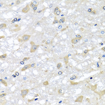 RPLP1 Antibody - Immunohistochemistry of paraffin-embedded rat brain tissue.