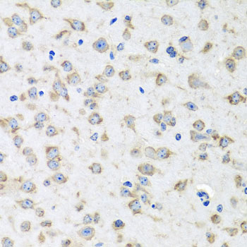 RPLP1 Antibody - Immunohistochemistry of paraffin-embedded mouse brain tissue.