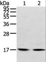 RPLP1 Antibody - Western blot analysis of Human normal liver tissue and hepg2 cell, using RPLP1 Polyclonal Antibody at dilution of 1:400.