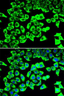 RPLP2 Antibody - Immunofluorescence analysis of U20S cells.