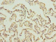RPLP2 Antibody - Immunohistochemistry of paraffin-embedded human lung tissue at dilution 1:100