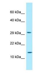 RPLP2 Antibody - RPLP2 antibody Western Blot of OVCAR-3.  This image was taken for the unconjugated form of this product. Other forms have not been tested.