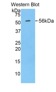 RPN1 / Ribophorin I Antibody - Western blot of recombinant RPN1 / Ribophorin I.  This image was taken for the unconjugated form of this product. Other forms have not been tested.