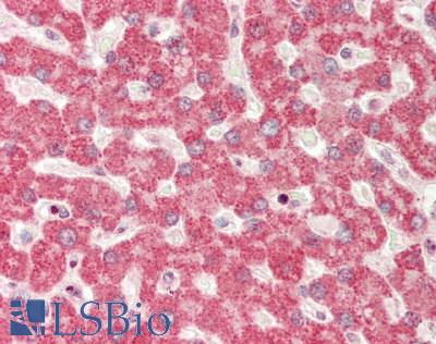 RPN1 / Ribophorin I Antibody - Human Liver: Formalin-Fixed, Paraffin-Embedded (FFPE).  This image was taken for the unconjugated form of this product. Other forms have not been tested.