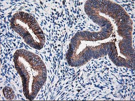 RPN1 / Ribophorin I Antibody - IHC of paraffin-embedded Human endometrium tissue using anti-RPN1 mouse monoclonal antibody.