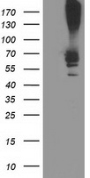 RPN1 / Ribophorin I Antibody - HEK293T cells were transfected with the pCMV6-ENTRY control (Left lane) or pCMV6-ENTRY RPN1 (Right lane) cDNA for 48 hrs and lysed. Equivalent amounts of cell lysates (5 ug per lane) were separated by SDS-PAGE and immunoblotted with anti-RPN1.