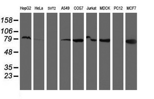 RPN1 / Ribophorin I Antibody - Western blot of extracts (35 ug) from 9 different cell lines by using anti-RPN1 monoclonal antibody.