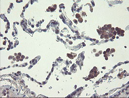 RPN1 / Ribophorin I Antibody - IHC of paraffin-embedded Human lung tissue using anti-RPN1 mouse monoclonal antibody.