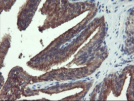 RPN1 / Ribophorin I Antibody - IHC of paraffin-embedded Human prostate tissue using anti-RPN1 mouse monoclonal antibody.