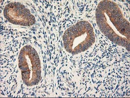 RPN1 / Ribophorin I Antibody - IHC of paraffin-embedded Human endometrium tissue using anti-RPN1 mouse monoclonal antibody.