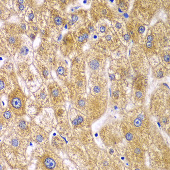 RPN1 / Ribophorin I Antibody - Immunohistochemistry of paraffin-embedded human liver injury tissue.