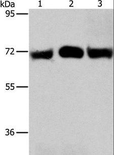 RPN1 / Ribophorin I Antibody - Western blot analysis of HeLa and A549 cell, human liver cancer tissue, using RPN1 Polyclonal Antibody at dilution of 1:350.