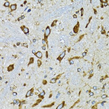 RPN1 / Ribophorin I Antibody - Immunohistochemistry of paraffin-embedded mouse spinal cord using RPN1 antibody at dilution of 1:100 (40x lens).