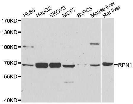 RPN1 / Ribophorin I Antibody - Western blot analysis of extracts of various cell lines, using RPN1 antibody at 1:1000 dilution. The secondary antibody used was an HRP Goat Anti-Rabbit IgG (H+L) at 1:10000 dilution. Lysates were loaded 25ug per lane and 3% nonfat dry milk in TBST was used for blocking. An ECL Kit was used for detection and the exposure time was 90s.