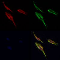 RPN1 / Ribophorin I Antibody - Staining HeLa cells by IF/ICC. The samples were fixed with PFA and permeabilized in 0.1% Triton X-100, then blocked in 10% serum for 45 min at 25°C. Samples were then incubated with primary Ab(1:200) and mouse anti-beta tubulin Ab(1:200) for 1 hour at 37°C. An AlexaFluor594 conjugated goat anti-rabbit IgG(H+L) Ab(1:200 Red) and an AlexaFluor488 conjugated goat anti-mouse IgG(H+L) Ab(1:600 Green) were used as the secondary antibod