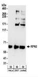 RPN2 / Ribophorin II Antibody - Detection of Human RPN2 by Western Blot. Samples: Whole cell lysate (50 ug) from HeLa, 293T, and Jurkat cells. Antibodies: Affinity purified rabbit anti-RPN2 antibody used for WB at 0.4 ug/ml. Detection: Chemiluminescence with an exposure time of 3 minutes.