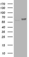 RPN2 / Ribophorin II Antibody - HEK293T cells were transfected with the pCMV6-ENTRY control (Left lane) or pCMV6-ENTRY RPN2 (Right lane) cDNA for 48 hrs and lysed. Equivalent amounts of cell lysates (5 ug per lane) were separated by SDS-PAGE and immunoblotted with anti-RPN2.