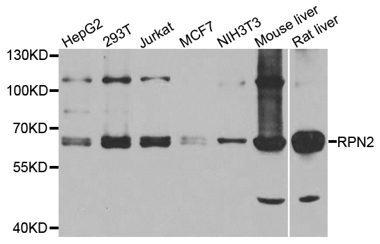 RPN2 / Ribophorin II Antibody - Western blot blot of extracts of various cell lines, using RPN2 antibody.
