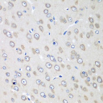 RPN2 / Ribophorin II Antibody - Immunohistochemistry of paraffin-embedded rat brain using RPN2 antibody at dilution of 1:100 (40x lens).
