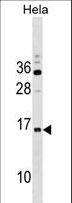RPP14 Antibody - RPP14 Antibody western blot of HeLa cell line lysates (35 ug/lane). The RPP14 antibody detected the RPP14 protein (arrow).