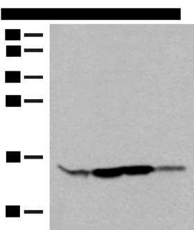 RPP14 Antibody - Western blot analysis of HL60 Hela 231 cell Human breast cancer tissue lysates  using RPP14 Polyclonal Antibody at dilution of 1:400