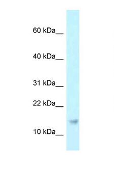 RPP21 Antibody - RPP21 antibody Western blot of U937 Cell lysate. Antibody concentration 1 ug/ml.  This image was taken for the unconjugated form of this product. Other forms have not been tested.