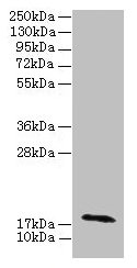 RPP21 Antibody - Western blot All lanes: RPP21 antibody at 12µg/ml + Colo320 whole cell lysate Secondary Goat polyclonal to rabbit IgG at 1/10000 dilution Predicted band size: 18, 21, 17, 19 kDa Observed band size: 18 kDa