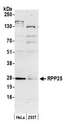 RPP25 Antibody - Detection of human RPP25 by western blot. Samples: Whole cell lysate (50 µg) from HeLa and 293T cells prepared using NETN lysis buffer. Antibody: Affinity purified rabbit anti-RPP25 antibody used for WB at 0.1 µg/ml. Detection: Chemiluminescence with an exposure time of 3 minutes.