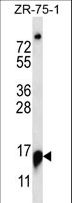 RPP25 Antibody - RPP25 Antibody western blot of ZR-75-1 cell line lysates (35 ug/lane). The RPP25 antibody detected the RPP25 protein (arrow).