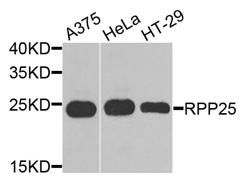 RPP25 Antibody - Western blot analysis of extracts of various cells.