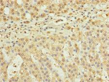 RPP25L / C9orf23 Antibody - Immunohistochemistry of paraffin-embedded human adrenal gland tissue at dilution of 1:100