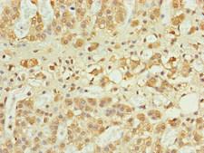 RPP25L / C9orf23 Antibody - Immunohistochemistry of paraffin-embedded human adrenal gland tissue at dilution of 1:100