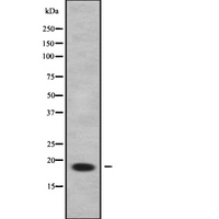RPP25L / C9orf23 Antibody - Western blot analysis of C9orf23 using LOVO cells whole cells lysates