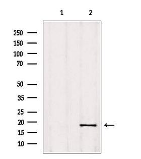 RPP25L / C9orf23 Antibody - Western blot analysis of extracts of 293 cells using C9orf23 antibody. Lane 1 was treated with the blocking peptide.