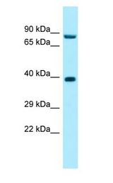 RPP30 Antibody - RPP30 antibody Western Blot of 293T.  This image was taken for the unconjugated form of this product. Other forms have not been tested.