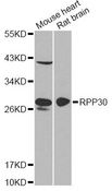 RPP30 Antibody - Western blot analysis of extracts of various cell lines, using RPP30 antibody at 1:1000 dilution. The secondary antibody used was an HRP Goat Anti-Rabbit IgG (H+L) at 1:10000 dilution. Lysates were loaded 25ug per lane and 3% nonfat dry milk in TBST was used for blocking. An ECL Kit was used for detection and the exposure time was 90s.