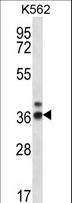 RPP38 Antibody - RPP38 Antibody western blot of K562 cell line lysates (35 ug/lane). The RPP38 antibody detected the RPP38 protein (arrow).