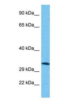 RPP38 Antibody - Western blot of RPP38 Antibody with human Jurkat Whole Cell lysate.  This image was taken for the unconjugated form of this product. Other forms have not been tested.